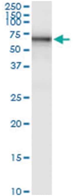 anti-STS, Human, IP-WB Antibody Pair, Abnova 1 Set:Antibodies, Monoclonal/Polyclonal
