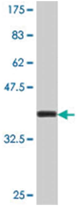 ARSE, Mouse, Polyclonal Antibody, Abnova 50 &mu;L | Buy Online | Abnova Corporation | Fisher Scientific