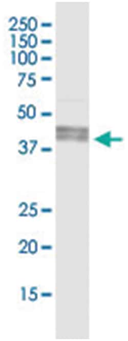 ART3, Human, IP-WB Antibody Pair (PW3), Abnova&trade;