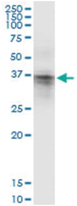 anti-ASPA, Human, IP-WB Antibody Pair, Abnova 1 Set:Antibodies, Monoclonal/Polyclonal