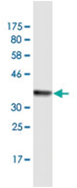 ATOH1 (M08A), Mouse anti-Human, Clone: 2A12, Abnova 200&mu;L; Unlabeled:Antibodies,