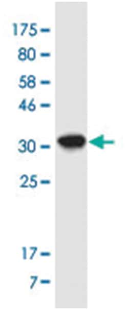 ATOX1, Mouse, Clone: 3A13, Abnova 200&mu;L; Unlabeled:Antibodies, Monoclonal