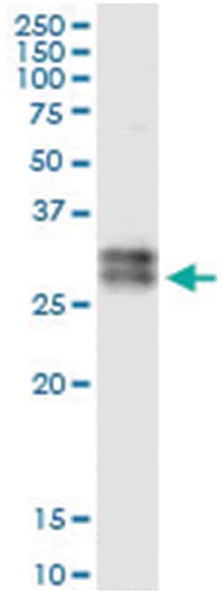 anti-ATP1B3, Human, IP-WB Antibody Pair, Abnova&trade;