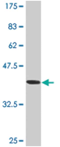 ATP2A1, Mouse, Clone: 3H4, Abnova 200&mu;L; Unlabeled:Antibodies, Monoclonal