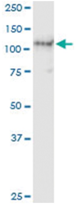 anti-AXL, Human, IP-WB Antibody Pair, Abnova&trade;