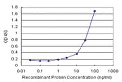 anti-B2M Matched Antibody Pair, Abnova 1 Set:Antibodies, Monoclonal/Polyclonal