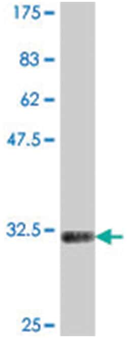 NKX3-2 (BAPX1), Mouse, Polyclonal Antibody, Abnova 50 &mu;L | Buy Online | Abnova Corporation | Fisher Scientific