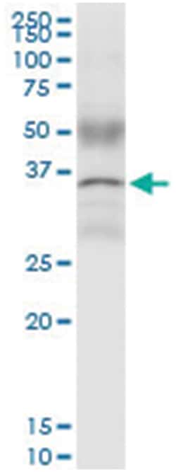 anti-CCND1, Human, IP-WB Antibody Pair, Abnova 1 Set:Antibodies, Monoclonal/Polyclonal