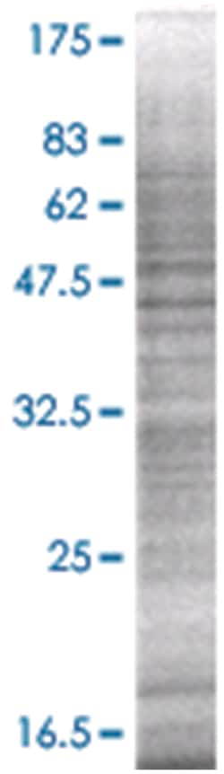 BCL2L2 293T Cell Overexpression Lysate (Denatured), Abnova