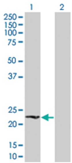 BCL2L2 293T Cell Overexpression Lysate (Denatured), Abnova