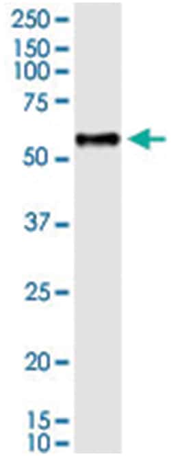 anti-BCL3, Human, IP-WB Antibody Pair, Abnova&trade;