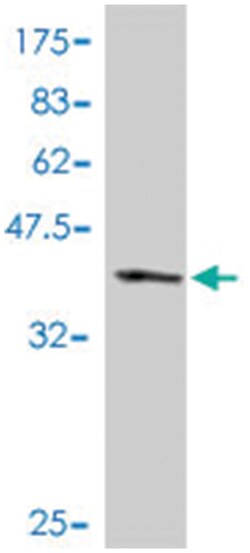 BCL9, Mouse, Polyclonal Antibody, Abnova 50 &mu;L | Buy Online | Abnova Corporation | Fisher Scientific