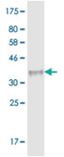 anti-TNFRSF17, Clone: 1A4, Abnova 100 &mu;g | Buy Online | Abnova Corporation | Fisher Scientific