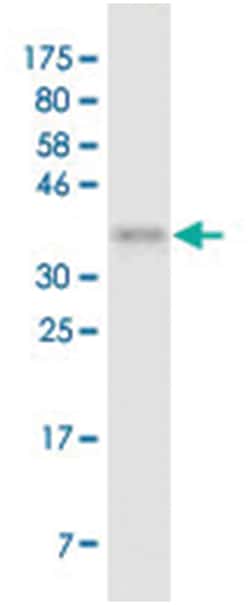 anti-TNFRSF17, Clone: 3D1, Abnova 100&mu;g, Unlabeled:Antibodies, Monoclonal