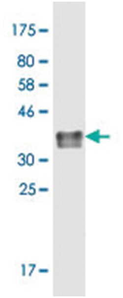anti-TNFRSF17, Clone: 8H2, Abnova 100 &mu;g | Buy Online | Abnova Corporation | Fisher Scientific