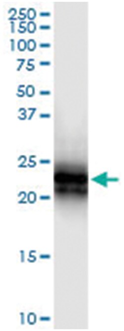 TNFRSF17, Human, IP-WB Antibody Pair (PW1), Abnova 1 Set:Antibodies, Monoclonal/Polyclonal