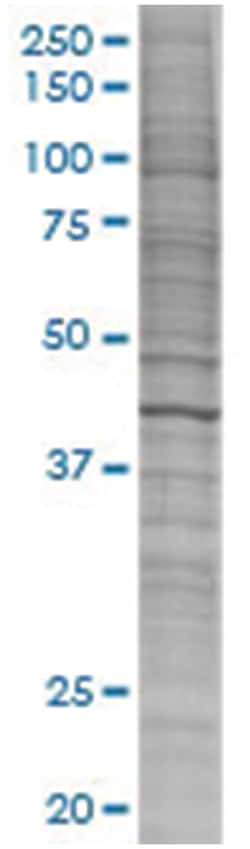 BCS1L 293T Cell Overexpression Lysate (Denatured), Abnova 100 &mu;L | Buy Online | Abnova | Fisher Scientific