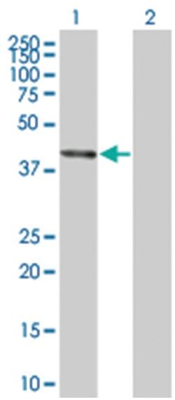 BCS1L 293T Cell Overexpression Lysate (Denatured), Abnova 100 &mu;L | Buy Online | Abnova | Fisher Scientific