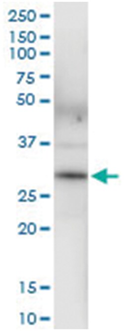 anti-BDH1, Human, IP-WB Antibody Pair, Abnova 1 Set:Antibodies, Monoclonal/Polyclonal