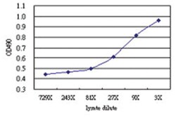 anti-BDKRB1 Matched Antibody Pair, Abnova™