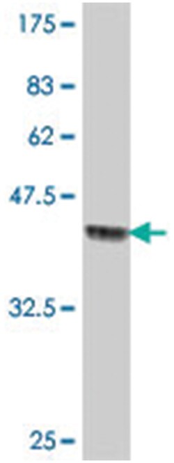 BFSP1, Mouse, Polyclonal Antibody, Abnova 50&mu;L; Unlabeled:Antibodies,