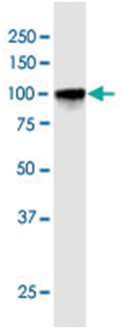 anti-PRDM1, Human, IP-WB Antibody Pair, Abnova&trade;