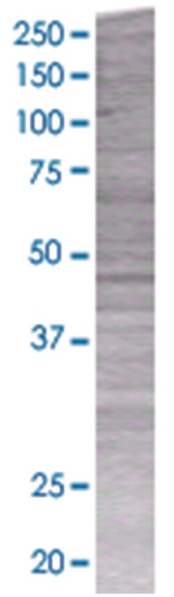 BMP7 293T Cell Overexpression Lysate (Denatured), Abnova 100 &mu;L | Buy Online | Abnova Corporation | Fisher Scientific