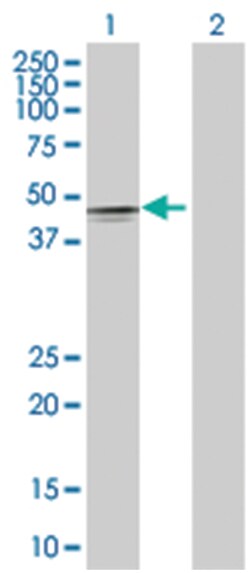 BMP7 293T Cell Overexpression Lysate (Denatured), Abnova 100 &mu;L | Buy Online | Abnova Corporation | Fisher Scientific