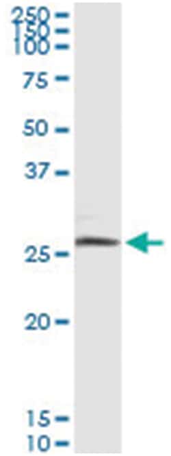 anti-BNIP3L, Human, IP-WB Antibody Pair, Abnova 1 Set:Antibodies, Monoclonal/Polyclonal