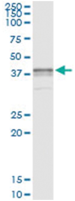 anti-BST1, Human, IP-WB Antibody Pair, Abnova™