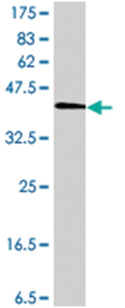 BST2, Mouse, Polyclonal Antibody, Abnova 50 &mu;L | Buy Online | Abnova | Fisher Scientific