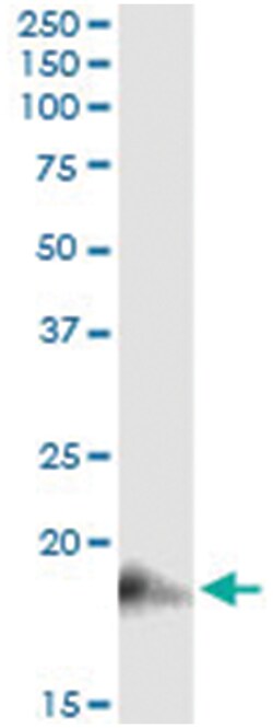 BST2, Human, IP-WB Antibody Pair (PW3), Abnova™