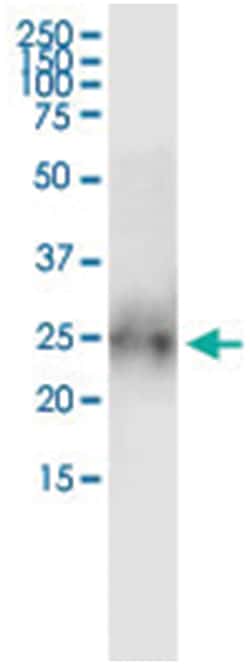 anti-BTC, Human, IP-WB Antibody Pair, Abnova&trade;
