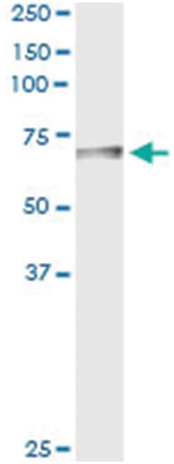 anti-BTD, Human, IP-WB Antibody Pair, Abnova 1 Set:Antibodies, Monoclonal/Polyclonal
