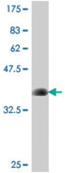KLF5, Mouse, Polyclonal Antibody, Abnova 50&mu;L; Unlabeled:Antibodies,