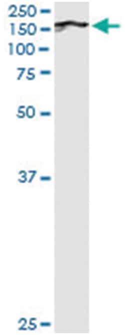 anti-BUB1, Human, IP-WB Antibody Pair, Abnova&trade;