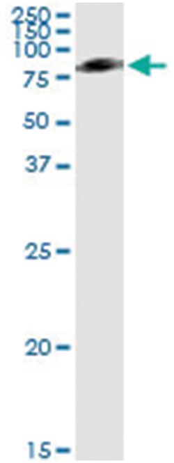 anti-SERPING1, Human, IP-WB Antibody Pair, Abnova™