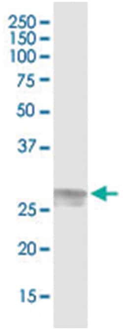 anti-C1QA, Human, IP-WB Antibody Pair, Abnova 1 Set:Antibodies, Monoclonal/Polyclonal