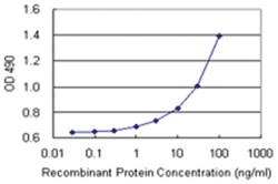anti-C1QB Matched Antibody Pair, Abnova 1 Set | Buy Online | Abnova | Fisher Scientific