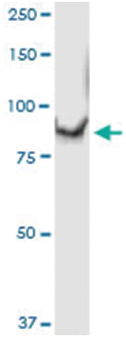 anti-C1S, Human, IP-WB Antibody Pair, Abnova™