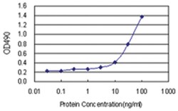 anti-C4BPB Ab-2 Matched Antibody Pair, Abnova™