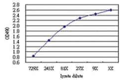 anti-C4BPB Ab-3 Matched Antibody Pair, Abnova&trade;