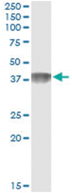 C4BPB, Human, IP-WB Antibody Pair (PW1), Abnova&trade;