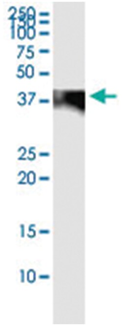 C4BPB, Human, IP-WB Antibody Pair (PW3), Abnova 1 Set:Antibodies, Monoclonal/Polyclonal