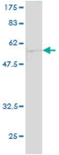 CA1, Mouse, Clone: 1E11, Abnova 100&mu;g; Unlabeled:Antibodies, Monoclonal