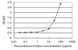 anti-CA3 Matched Antibody Pair, Abnova 1 Set:Antibodies, Monoclonal/Polyclonal