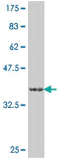 CA8, Mouse, Polyclonal Antibody, Abnova 50&mu;L; Unlabeled:Antibodies,