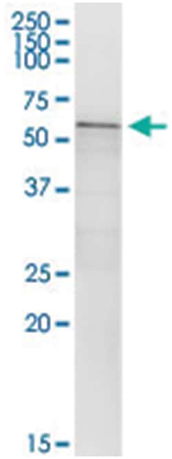 anti-CA9, Human, IP-WB Antibody Pair, Abnova&trade;