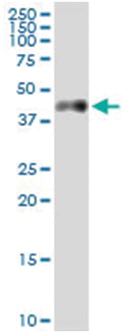 anti-CA12, Human, IP-WB Antibody Pair, Abnova™