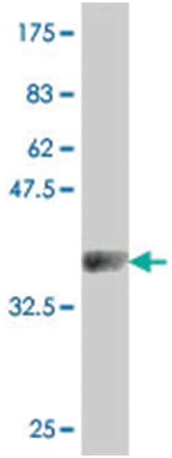 CACNA1S, Mouse, Polyclonal Antibody, Abnova 50 &mu;L | Buy Online | Abnova | Fisher Scientific
